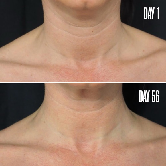 B POISED — MAELY’S COSMETICS NECK & DÉCOLLETAGE FIRMING LOTION — NEW - Picture 8 of 8